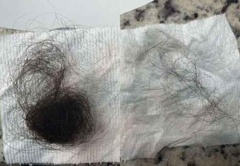 NOTICED SIGNIFICANTLY LESS SHEDDING WITHIN 30 DAYS