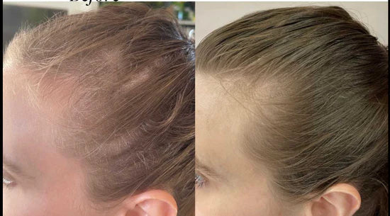 FELT MORE CONFIDENT WITH HAIR AND BLADDER IMPROVEMENT