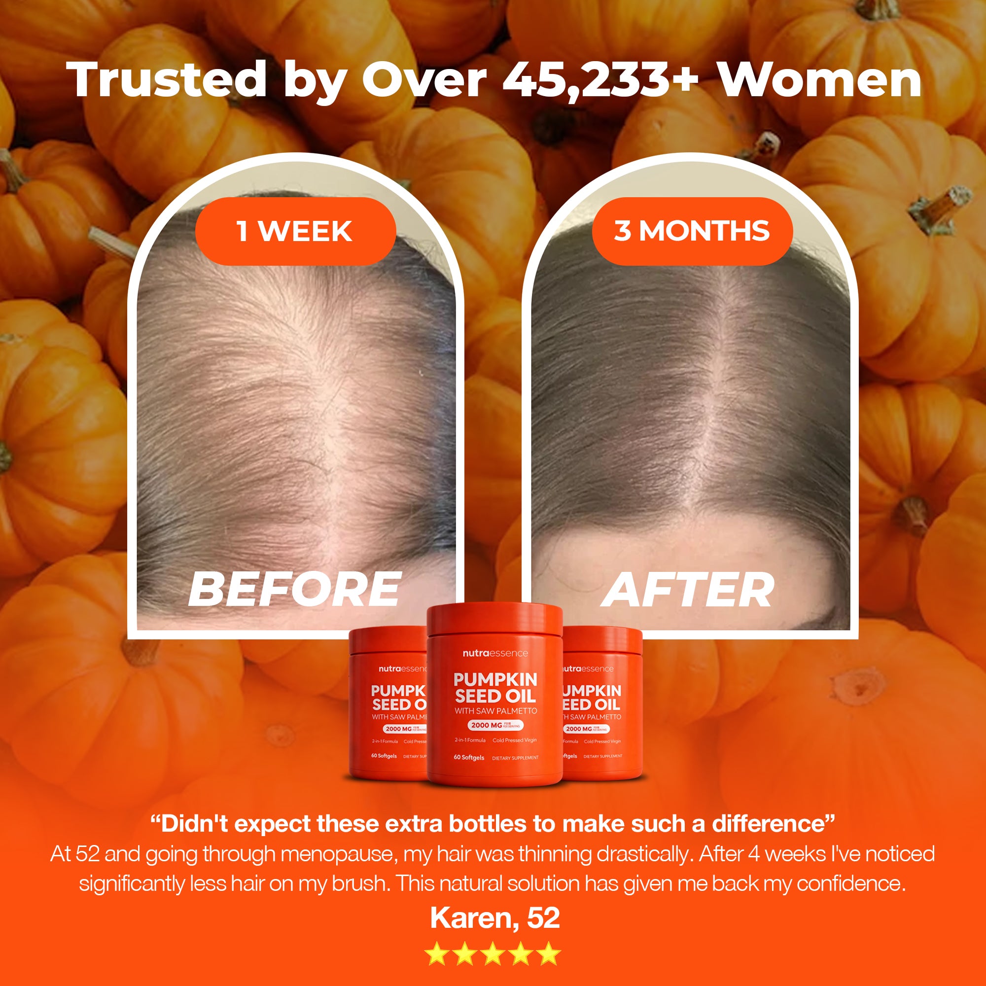 Complete the 180-Day Hair Recovery Protocol