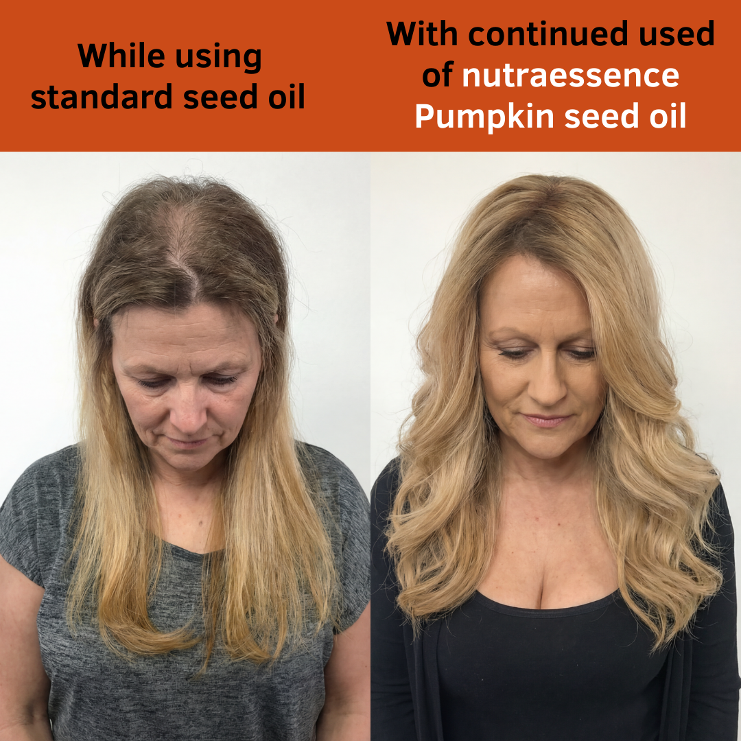 Pumpkin Seed Oil Softgels - A0002