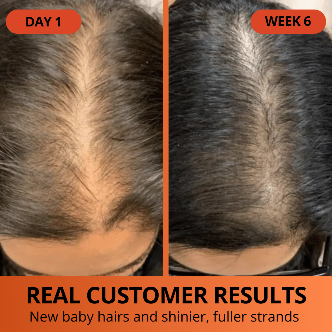 Pumpkin Seed Oil Softgels