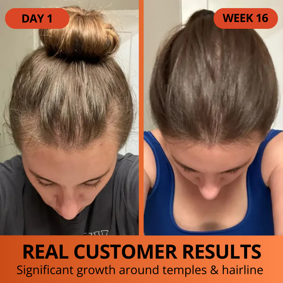 Pumpkin Seed Oil Softgels