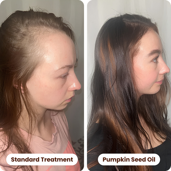 Support Hair Growth at the Source