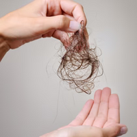 POSTPARTUM OR MENOPAUSAL HAIR LOSS