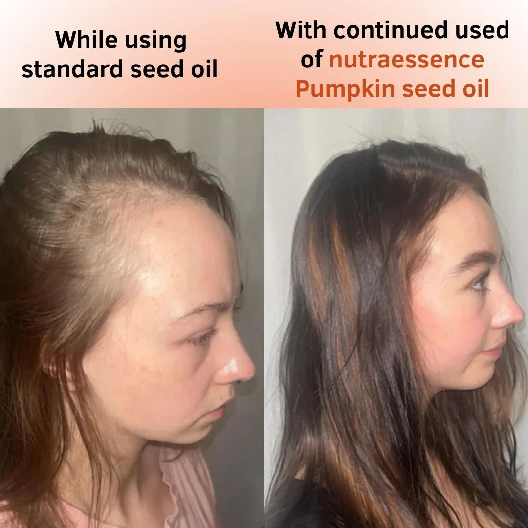 Experience Real, Root-Level Hair Recovery